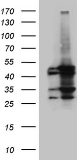 MCAD / ACADM Antibody - HEK293T cells were transfected with the pCMV6-ENTRY control. (Left lane) or pCMV6-ENTRY ACADM. (Right lane) cDNA for 48 hrs and lysed. Equivalent amounts of cell lysates. (5 ug per lane) were separated by SDS-PAGE and immunoblotted with anti-ACADM. (1:2000)