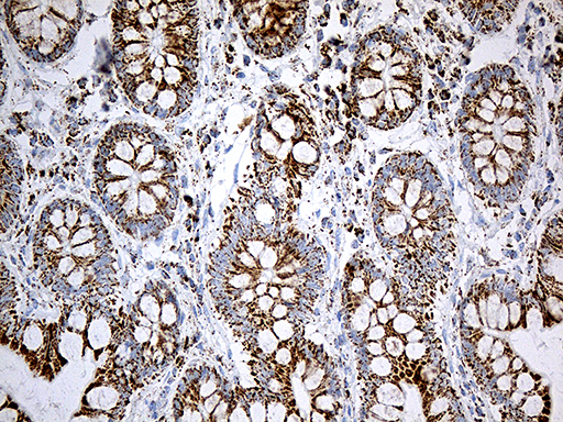 MCAD / ACADM Antibody - Immunohistochemical staining of paraffin-embedded Human colon tissue within the normal limits using anti-ACADM mouse monoclonal antibody. (Heat-induced epitope retrieval by 1mM EDTA in 10mM Tris buffer. (pH8.5) at 120°C for 3 min. (1:500)