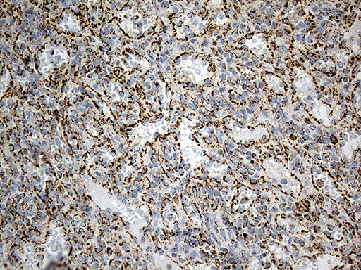 MCAD / ACADM Antibody - Immunohistochemical staining of paraffin-embedded Human spleen tissue within the normal limits using anti-ACADM mouse monoclonal antibody. (Heat-induced epitope retrieval by 1mM EDTA in 10mM Tris buffer. (pH8.5) at 120°C for 3 min. (1:500)