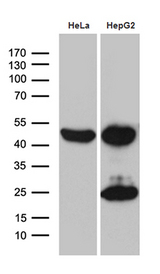 MCAD / ACADM Antibody - Western blot analysis of extracts. (35ug) from 2 different cell lines by using anti-ACADM monoclonal antibody. (1:500)