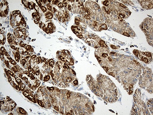 MCAD / ACADM Antibody - Immunohistochemical staining of paraffin-embedded Human gastric tissue within the normal limits using anti-ACADM mouse monoclonal antibody. (Heat-induced epitope retrieval by 1mM EDTA in 10mM Tris buffer. (pH8.5) at 120°C for 3 min. (1:500)