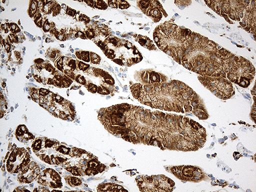 MCAD / ACADM Antibody - Immunohistochemical staining of paraffin-embedded Human gastric tissue within the normal limits using anti-ACADM mouse monoclonal antibody. (Heat-induced epitope retrieval by 1mM EDTA in 10mM Tris buffer. (pH8.5) at 120°C for 3 min. (1:500)