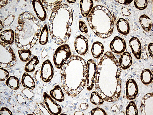 MCAD / ACADM Antibody - Immunohistochemical staining of paraffin-embedded Human Kidney tissue within the normal limits using anti-ACADM mouse monoclonal antibody. (Heat-induced epitope retrieval by 1mM EDTA in 10mM Tris buffer. (pH8.5) at 120°C for 3 min. (1:500)