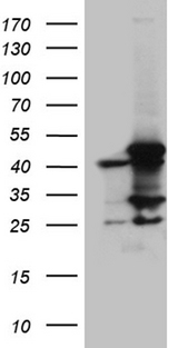 MCAD / ACADM Antibody - HEK293T cells were transfected with the pCMV6-ENTRY control. (Left lane) or pCMV6-ENTRY ACADM. (Right lane) cDNA for 48 hrs and lysed