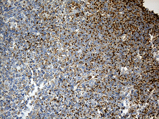 MCAD / ACADM Antibody - Immunohistochemical staining of paraffin-embedded Human tonsil within the normal limits using anti-ACADM mouse monoclonal antibody. (Heat-induced epitope retrieval by 1mM EDTA in 10mM Tris buffer. (pH8.5) at 120°C for 3 min. (1:500)