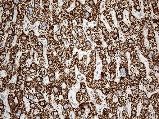 MCAD / ACADM Antibody - Immunohistochemical staining of paraffin-embedded Human liver tissue within the normal limits using anti-ACADM mouse monoclonal antibody. (Heat-induced epitope retrieval by 1mM EDTA in 10mM Tris buffer. (pH8.5) at 120°C for 3 min. (1:500)