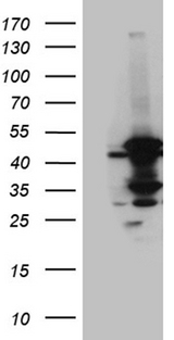 MCAD / ACADM Antibody - HEK293T cells were transfected with the pCMV6-ENTRY control. (Left lane) or pCMV6-ENTRY ACADM. (Right lane) cDNA for 48 hrs and lysed. Equivalent amounts of cell lysates. (5 ug per lane) were separated by SDS-PAGE and immunoblotted with anti-ACADM. (1:2000)