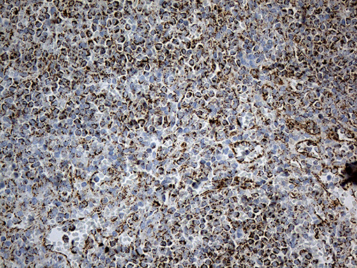 MCAD / ACADM Antibody - Immunohistochemical staining of paraffin-embedded Human spleen tissue within the normal limits using anti-ACADM mouse monoclonal antibody. (Heat-induced epitope retrieval by 1mM EDTA in 10mM Tris buffer. (pH8.5) at 120°C for 3 min. (1:500)