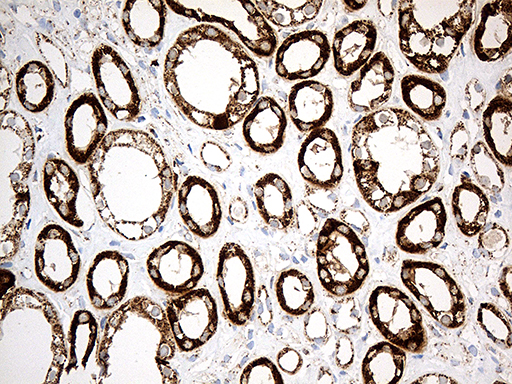 MCAD / ACADM Antibody - Immunohistochemical staining of paraffin-embedded Human Kidney tissue within the normal limits using anti-ACADM mouse monoclonal antibody. (Heat-induced epitope retrieval by 1mM EDTA in 10mM Tris buffer. (pH8.5) at 120°C for 3 min. (1:500)