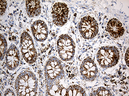MCAD / ACADM Antibody - Immunohistochemical staining of paraffin-embedded Human colon tissue within the normal limits using anti-ACADM mouse monoclonal antibody. (Heat-induced epitope retrieval by 1mM EDTA in 10mM Tris buffer. (pH8.5) at 120°C for 3 min. (1:500)
