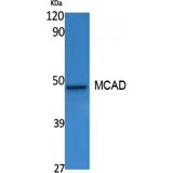 MCAD / ACADM Antibody - Western blot of MCAD antibody