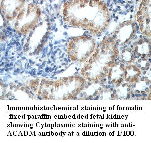 MCAD / ACADM Antibody