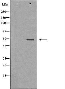 MCAD / ACADM Antibody - Western blot analysis of extracts of HepG2 cells using ACADM antibody. The lane on the left is treated with the antigen-specific peptide.