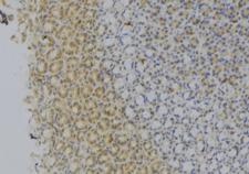 MCAD / ACADM Antibody - 1:100 staining human gastric tissue by IHC-P. The sample was formaldehyde fixed and a heat mediated antigen retrieval step in citrate buffer was performed. The sample was then blocked and incubated with the antibody for 1.5 hours at 22°C. An HRP conjugated goat anti-rabbit antibody was used as the secondary.