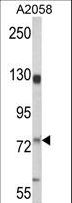 MCAM / CD146 Antibody - Western blot of MCAM Antibody in A2058 cell line lysates (35 ug/lane). MCAM (arrow) was detected using the purified antibody.(2 ug/ml)