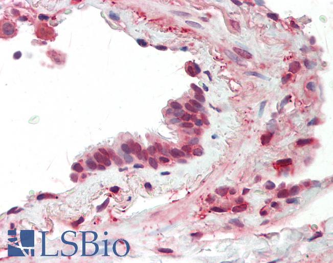 MCAM / CD146 Antibody - Anti-MCAM / CD146 antibody IHC staining of human lung, respiratory epithelium. Immunohistochemistry of formalin-fixed, paraffin-embedded tissue after heat-induced antigen retrieval. Antibody concentration 10 ug/ml.  This image was taken for the unconjugated form of this product. Other forms have not been tested.