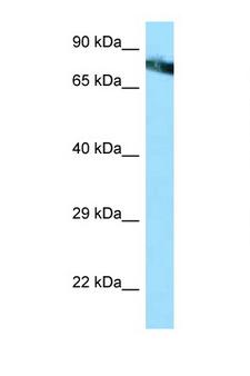 MCAM / CD146 Antibody - MCAM / CD146 antibody Western blot of HepG2 Cell lysate. Antibody concentration 1 ug/ml. This image was taken for the unconjugated form of this product. Other forms have not been tested.