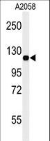 MCAM / CD146 Antibody - Western blot of MCAM Antibody in A2058 cell line lysates (35 ug/lane). MCAM (arrow) was detected using the purified antibody.