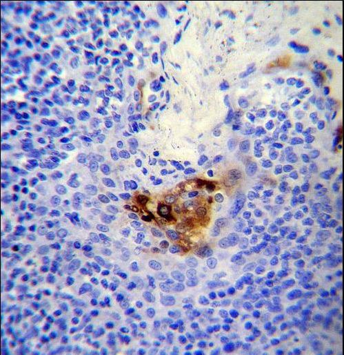 MCAM / CD146 Antibody - MCAM Antibody immunohistochemistry of formalin-fixed and paraffin-embedded human tonsil tissue followed by peroxidase-conjugated secondary antibody and DAB staining.