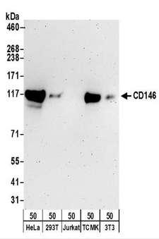 MCAM / CD146 Antibody - Detection of Human and Mouse CD146 by Western Blot. Samples: Whole cell lysate (50 ug) from HeLa, 293T, Jurkat, mouse TCMK-1, and mouse NIH3T3 cells. Antibodies: Affinity purified rabbit anti-CD146 antibody used for WB at 0.1 ug/ml. Detection: Chemiluminescence with an exposure time of 3 minutes.