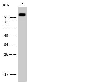 MCAM / CD146 Antibody - Anti-MCAM rabbit monoclonal antibody at 1:500 dilution. Lane A: Mouse liver tissue lysate. Lysates/proteins at 30 ug per lane. Secondary: Goat Anti-Rabbit IgG (H+L)/HRP at 1/10000 dilution. Developed using the ECL technique. Performed under reducing conditions. Predicted band size: 72 kDa.