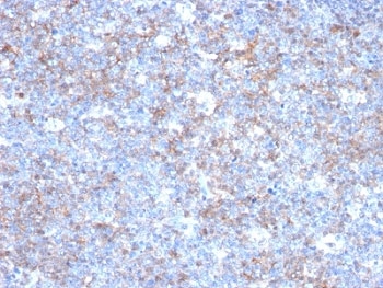 MCAM / CD146 Antibody - Formalin-fixed, paraffin-embedded human tonsil stained with CD146 antibody (C146/634).  This image was taken for the unmodified form of this product. Other forms have not been tested.