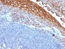 MCAM / CD146 Antibody - Formalin-fixed, paraffin-embedded human tonsil stained with CD146 antibody (MUC18/1130).  This image was taken for the unmodified form of this product. Other forms have not been tested.