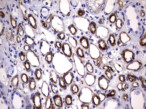 MCAM / CD146 Antibody - IHC of paraffin-embedded Human Kidney tissue using anti-MCAM mouse monoclonal antibody. (Heat-induced epitope retrieval by 1 mM EDTA in 10mM Tris, pH9.0, 120°C for 3min).