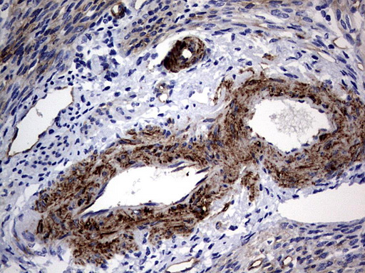 MCAM / CD146 Antibody - IHC of paraffin-embedded Human endometrium tissue using anti-MCAM mouse monoclonal antibody. (Heat-induced epitope retrieval by 1 mM EDTA in 10mM Tris, pH9.0, 120°C for 3min).