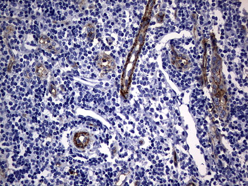 MCAM / CD146 Antibody - IHC of paraffin-embedded Human tonsil using anti-MCAM mouse monoclonal antibody. (Heat-induced epitope retrieval by 1 mM EDTA in 10mM Tris, pH9.0, 120°C for 3min).