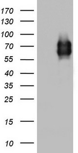 MCAM / CD146 Antibody - HEK293T cells were transfected with the pCMV6-ENTRY control (Left lane) or pCMV6-ENTRY MCAM (Right lane) cDNA for 48 hrs and lysed. Equivalent amounts of cell lysates (5 ug per lane) were separated by SDS-PAGE and immunoblotted with anti-MCAM.