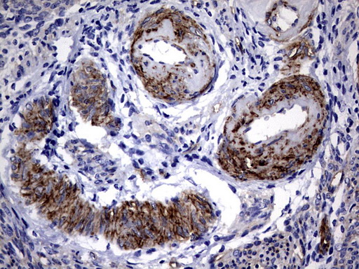 MCAM / CD146 Antibody - IHC of paraffin-embedded Human endometrium tissue using anti-MCAM mouse monoclonal antibody. (Heat-induced epitope retrieval by 1 mM EDTA in 10mM Tris, pH9.0, 120°C for 3min).