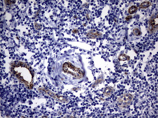 MCAM / CD146 Antibody - IHC of paraffin-embedded Human tonsil using anti-MCAM mouse monoclonal antibody. (Heat-induced epitope retrieval by 1 mM EDTA in 10mM Tris, pH9.0, 120°C for 3min).