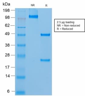 MCAM / CD146 Antibody - SDS-PAGE Analysis of Purified MUC18 Mouse Recombinant Monoclonal Antibody (rMUC18/1130). Confirmation of Purity and Integrity of Antibody.