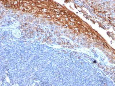 MCAM / CD146 Antibody - Formalin-fixed, paraffin-embedded human Tonsil stained with MUC18 Mouse Recombinant Monoclonal Antibody (rMUC18/1130).