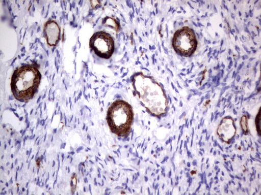 MCAM / CD146 Antibody - Immunohistochemical staining of paraffin-embedded Human Ovary tissue using anti-MCAM mouse monoclonal antibody.  heat-induced epitope retrieval by 1 mM EDTA in 10mM Tris, pH9.0, 120C for 3min)
