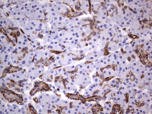 MCAM / CD146 Antibody - Immunohistochemical staining of paraffin-embedded Human pancreas tissue using anti-MCAM mouse monoclonal antibody.  heat-induced epitope retrieval by 1 mM EDTA in 10mM Tris, pH9.0, 120C for 3min)