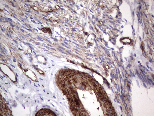 MCAM / CD146 Antibody - Immunohistochemical staining of paraffin-embedded Human endometrium tissue using anti-MCAM mouse monoclonal antibody.  heat-induced epitope retrieval by 1 mM EDTA in 10mM Tris, pH9.0, 120C for 3min)