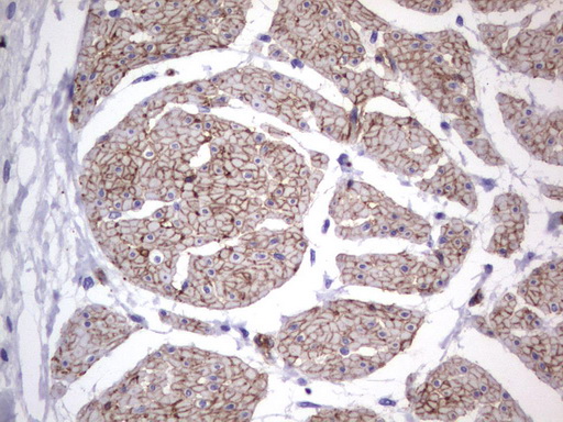 MCAM / CD146 Antibody - Immunohistochemical staining of paraffin-embedded Human bladder tissue using anti-MCAM mouse monoclonal antibody.  heat-induced epitope retrieval by 1 mM EDTA in 10mM Tris, pH9.0, 120C for 3min)