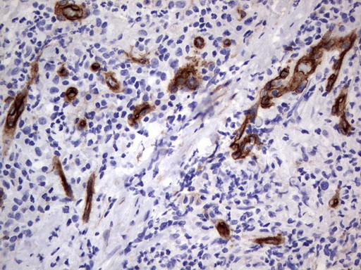 MCAM / CD146 Antibody - Immunohistochemical staining of paraffin-embedded Human lymph node tissue using anti-MCAM mouse monoclonal antibody.  heat-induced epitope retrieval by 1 mM EDTA in 10mM Tris, pH9.0, 120C for 3min)