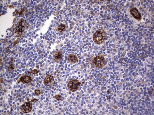 MCAM / CD146 Antibody - Immunohistochemical staining of paraffin-embedded Human tonsil using anti-MCAMmouse monoclonal antibody.  heat-induced epitope retrieval by 1 mM EDTA in 10mM Tris, pH9.0, 120C for 3min)