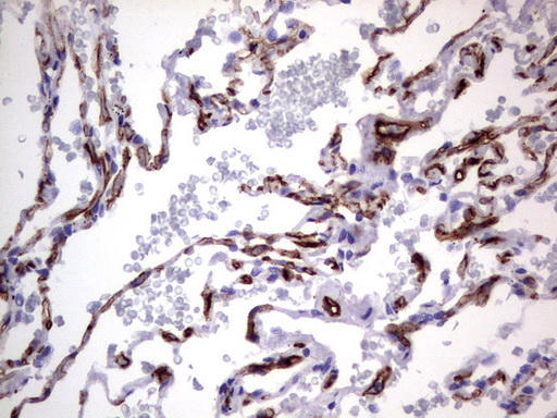 MCAM / CD146 Antibody - Immunohistochemical staining of paraffin-embedded Human lung tissue using anti-MCAM mouse monoclonal antibody.  heat-induced epitope retrieval by 1 mM EDTA in 10mM Tris, pH9.0, 120C for 3min)