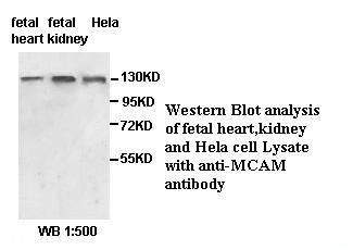 MCAM / CD146 Antibody