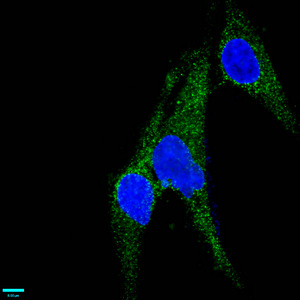 MCAM / CD146 Antibody - Immunofluorescence staining of U251 cells diluted at 1:37,counter-stained with DAPI. The cells were fixed in 4% formaldehyde, permeabilized using 0.2% Triton X-100 and blocked in 10% normal Goat Serum. The cells were then incubated with the antibody overnight at 4°C.The Secondary antibody was Alexa Fluor 488-congugated AffiniPure Goat Anti-Rabbit IgG (H+L).