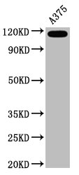 MCAM / CD146 Antibody - Western Blot Positive WB detected in:A375 whole cell lysate All Lanes:CD146 antibody at 0.6µg/ml Secondary Goat polyclonal to rabbit IgG at 1/50000 dilution Predicted band size: 72 KDa Observed band size: 120 KDa