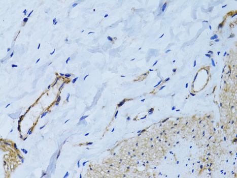MCAM / CD146 Antibody - Immunohistochemistry of paraffin-embedded human colon using MCAM antibody at dilution of 1:100 (40x lens).