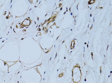 MCAM / CD146 Antibody - Immunohistochemistry of paraffin-embedded human breast using MCAM antibody at dilution of 1:100 (40x lens).