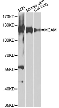 MCAM / CD146 Antibody - Western blot analysis of extracts of various cell lines, using MCAM antibody at 1:1000 dilution. The secondary antibody used was an HRP Goat Anti-Rabbit IgG (H+L) at 1:10000 dilution. Lysates were loaded 25ug per lane and 3% nonfat dry milk in TBST was used for blocking. An ECL Kit was used for detection and the exposure time was 30s.