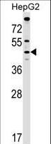 MCAT Antibody - MCAT Antibody western blot of HepG2 cell line lysates (35 ug/lane). The MCAT antibody detected the MCAT protein (arrow).