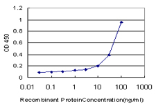 MCAT Antibody - Detection limit for recombinant GST tagged MT is approximately 1 ng/ml as a capture antibody.